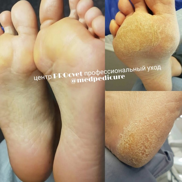 уникальная работа кожи.jpg
